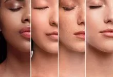 Skin Types 1