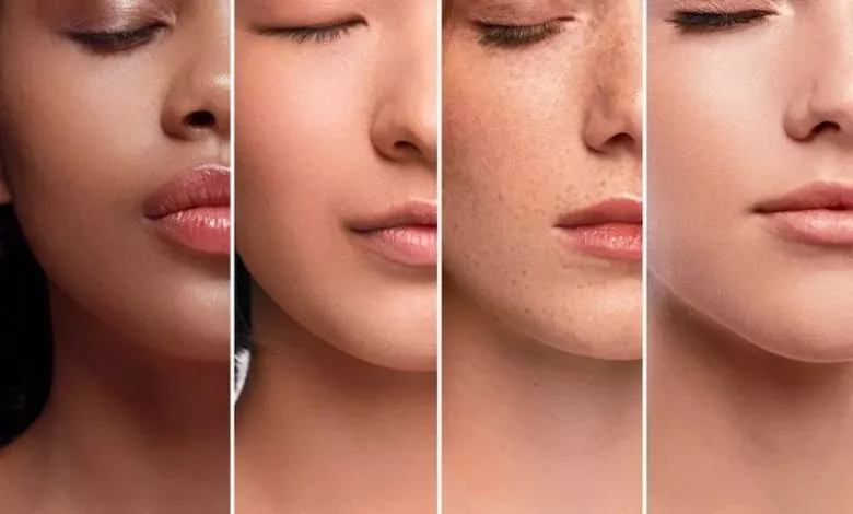Skin Types 1