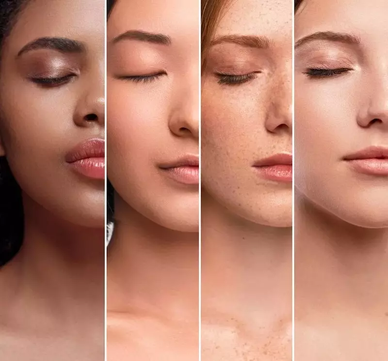 Skin Types 1