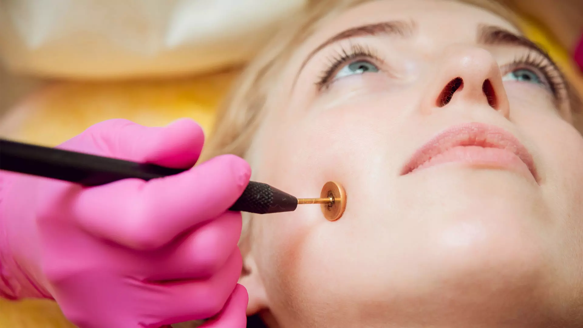 Service Demodex 1920