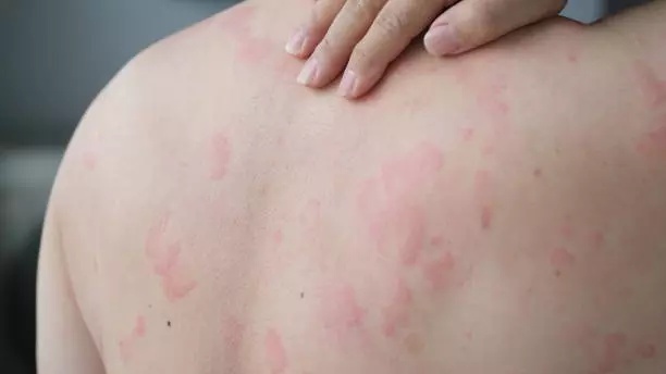 Istockphoto 1602153651 612x612 1