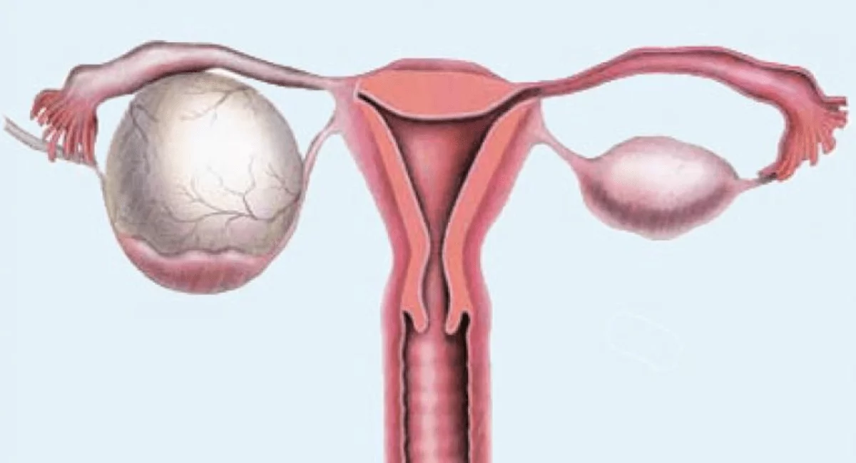 Dlya Statej Sajta 2023 12 21t181254.098